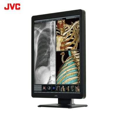 KENWOOD - 医療用 モニター  JVC KENWOOD 21.5型 CCL220 動作良好 KENWOOD - 医療用 モニター JVC KENWOOD 21.5型 CCL220 動作良好