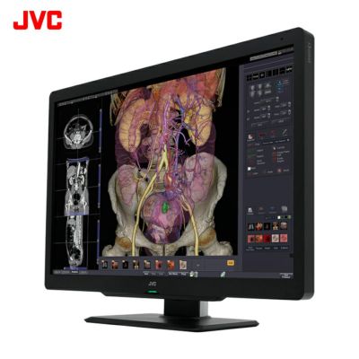 医用画像表示モニター | JVCケンウッドストア 医用画像表示モニター | JVCケンウッドストア